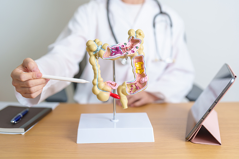 Doctor pointing at a human colorectal anatomy model during a medical consultation.