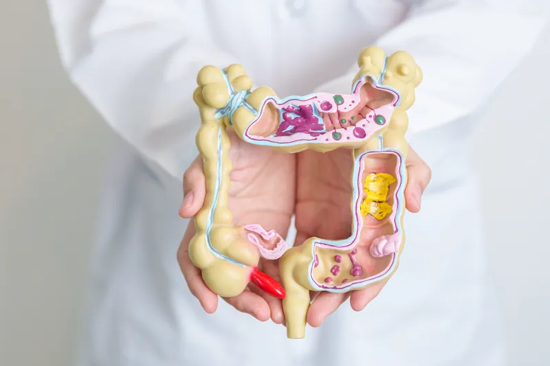 Colorectal surgeon holding model of colon