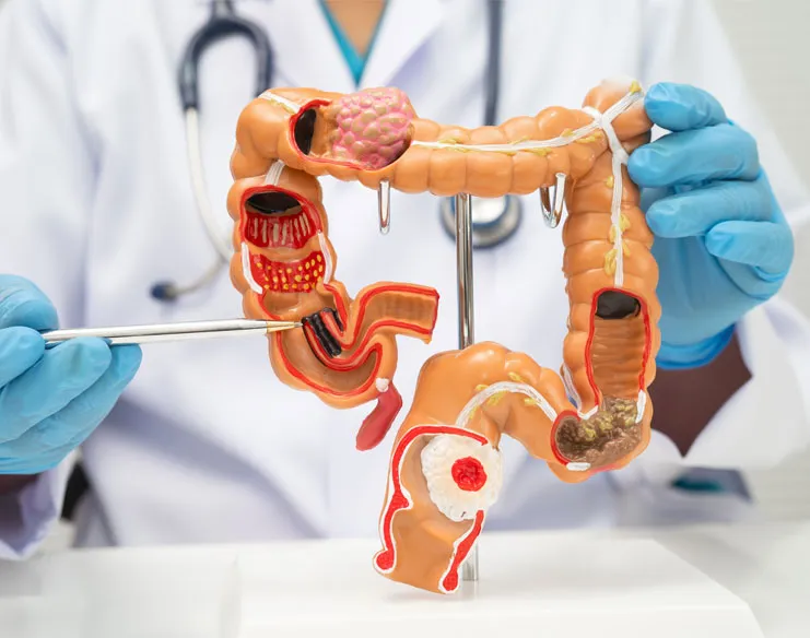 Doctor holding an anatomical model of the colon and large intestine to explain colorectal health and digestive conditions.