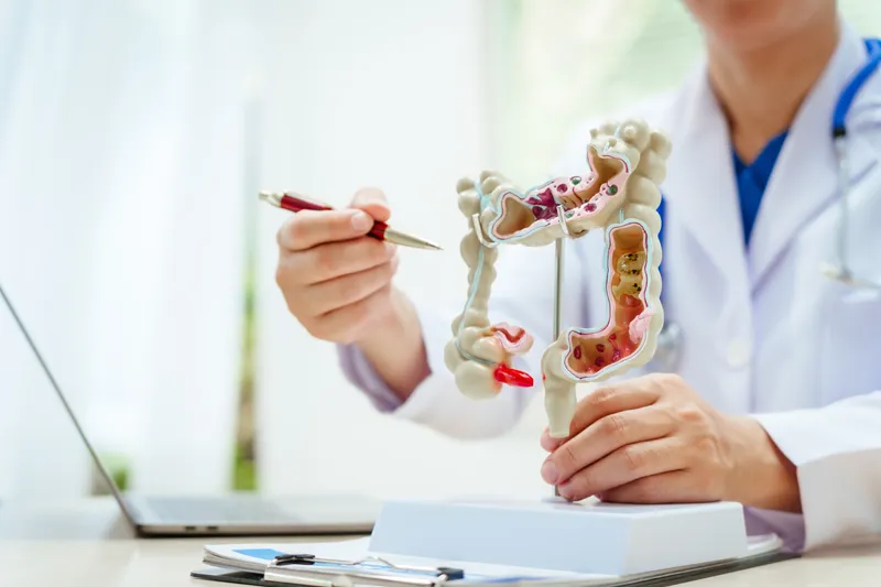 Colorectal surgeon pointing to an anatomical model of the colon