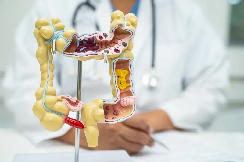 Colorectal specialist with an anatomical model of the colon and rectum during a consultation