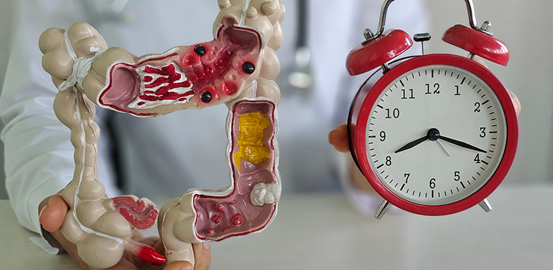 A colorectal specialist holding a clock and a model of the colon.