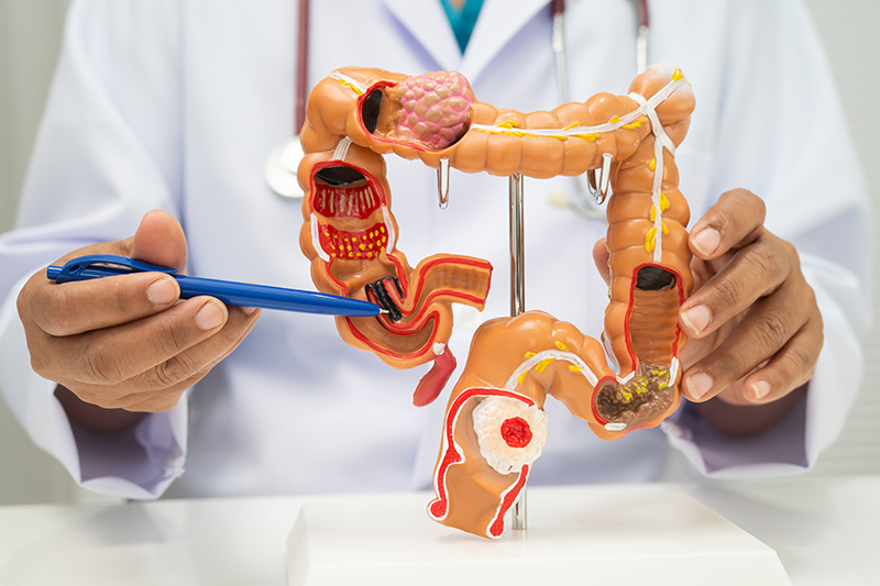 Doctor with an intestine anatomy model