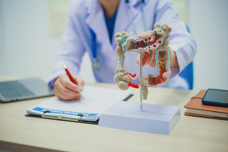 A Crohn's Disease Specialist with an anatomical model
