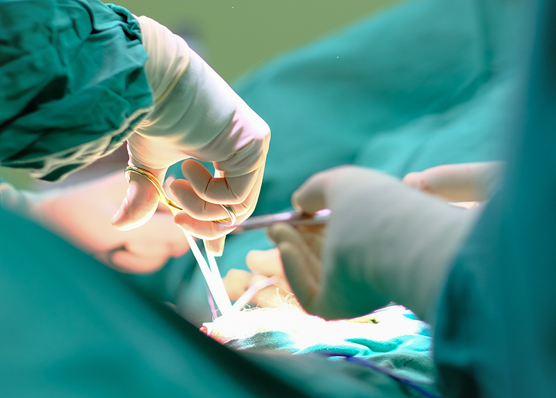 Surgeon wearing sterile gloves performing a medical procedure in an operating theatre.
