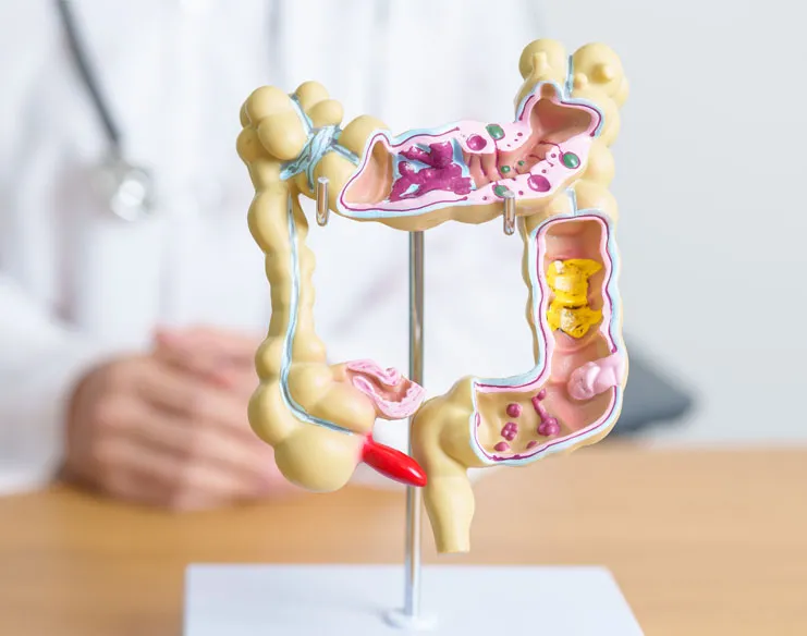 Doctor with an anatomical model of the human colon to explain digestive health and colorectal conditions.