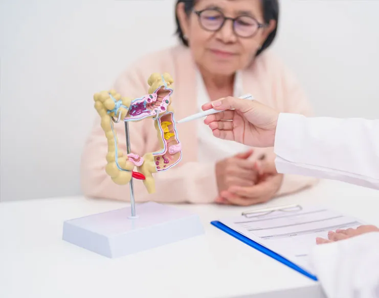 Elderly female patient consulting with a doctor while the doctor explains digestive health using a colon anatomy model.