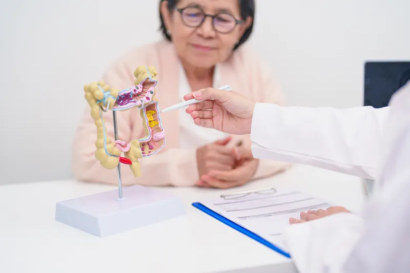 Doctor reviewing colonoscopy findings with a patient during a consultation about ulcerative colitis