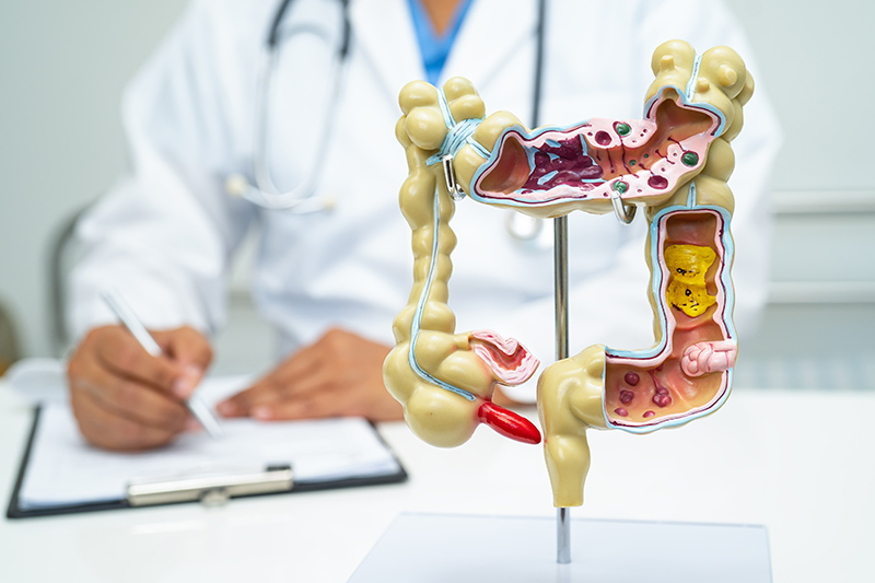 Doctor with a human colon and digestive system anatomy model in a clinic setting.
