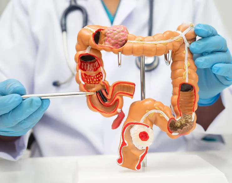 Colorectal cancer surgeon reviewing colonoscopy results with patient.